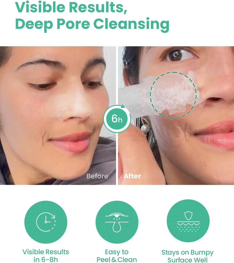 GLAM UP Spotless Nose Patch Hydrocolloid Coverage for Nose Pores,Zits and Oil - Strong Waterproof to Absorb Acne Nose Gunk, and Calm Treatment with Tea Tree (12 Patches)