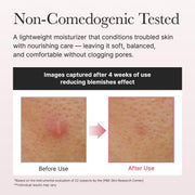 Red Smoothie Lotion 5, Face Moisturizer with Niacinamide 5%, Collagen, Peptide Complex, Hydrating Skin Care, 6.76 fl oz