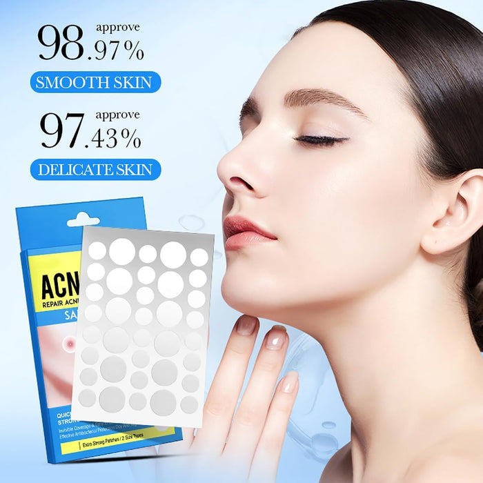 NALACAL Salicylic Acid Acne Patch - Hides Facial Pimples Hydrocolloid Patches - Not Tested on Animals, Microneedle Spot Skincare Patches, Mighty Smallpox Treatment Stickers, Zit Remover, (36 Pcs*2)