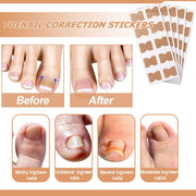 Multi-Purpose Nail Repair Patches 50Pcs, Nail Repair Toenail Treatment for Nail Fungus Damage, 8-Hour Treatment Restores Healthy Appearance