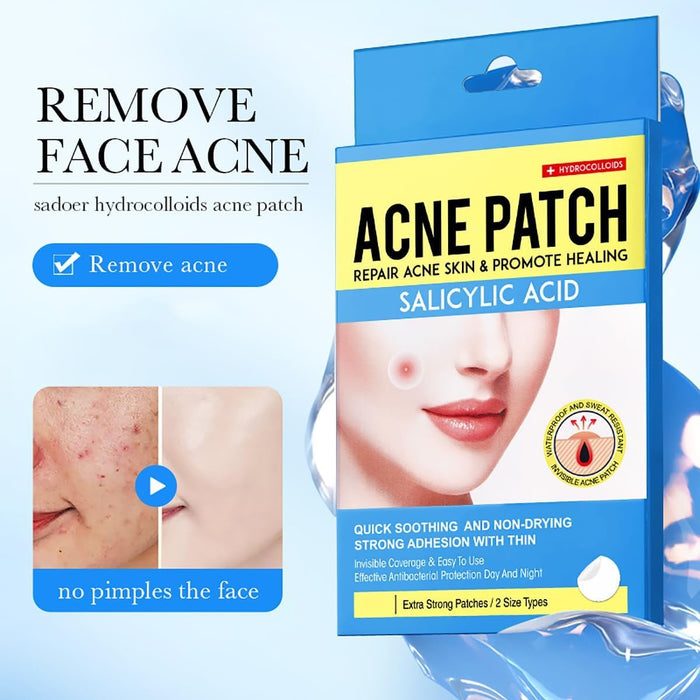 NALACAL Salicylic Acid Acne Patch - Hides Facial Pimples Hydrocolloid Patches - Not Tested on Animals, Microneedle Spot Skincare Patches, Mighty Smallpox Treatment Stickers, Zit Remover, (36 Pcs*2)