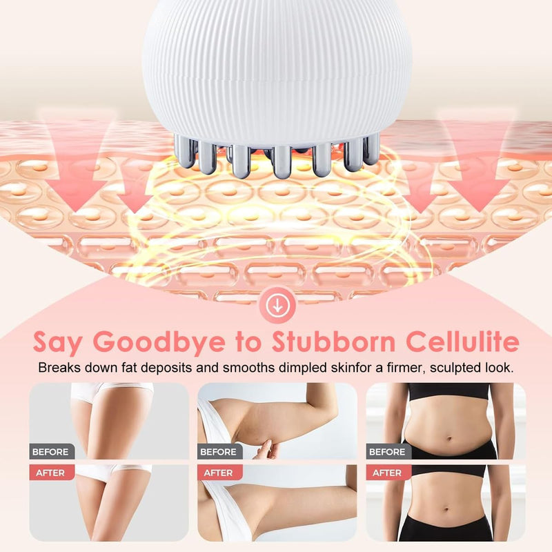 HANNEA Lymphatic Drainage Massager & Anti-Cellulite Tool for Legs, Arms, Belly Sculpting Machine with Microcurrent, Light, Heat, Vibration Reduces Stretch Marks Rechargeable White