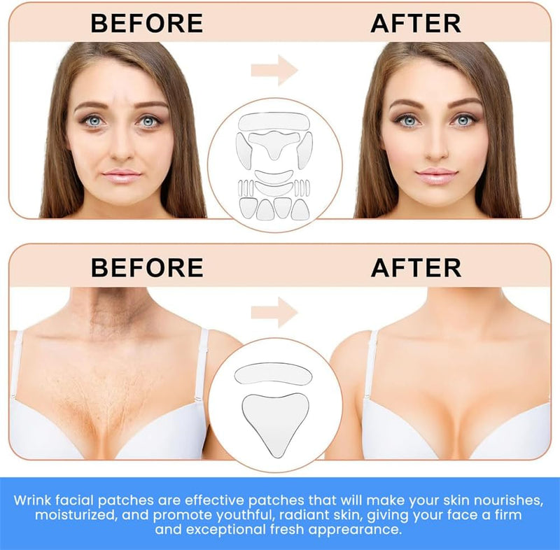 Face and Forehead Wrinkle Patches, 18 Pcs Anti Wrinkle Facial Patches for Face Overnight to Reduce Fine Wrinkles, Frown and Smile Lines, Facial Patches for Wrinkles Treatment for Women and Men