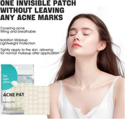 Vavilente Acne Pimple Patches,Hydrocolloid Acne Patch for Covering Face, Blemishes, Zits Absorbing Patch,Cosmetics Patch for Pimple Dots, Acne Treatment, Invisible Acne Spot Patches(150 Count)