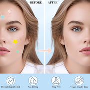 200Pcs Acne Pimple Patches, Hydrocolloid Acne Patch,Pimple Patches for Face, Colorful Star Pimple Spot Sticker with Hyaluronic Acid, for Covering Zits and Blemishes