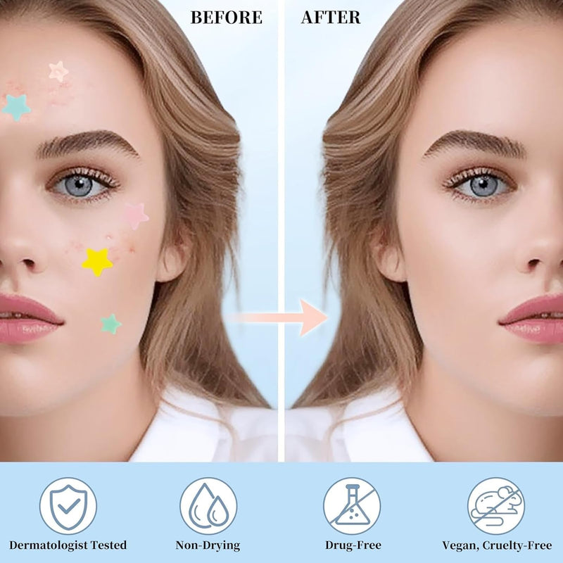 200Pcs Acne Pimple Patches, Hydrocolloid Acne Patch,Pimple Patches for Face, Colorful Star Pimple Spot Sticker with Hyaluronic Acid, for Covering Zits and Blemishes