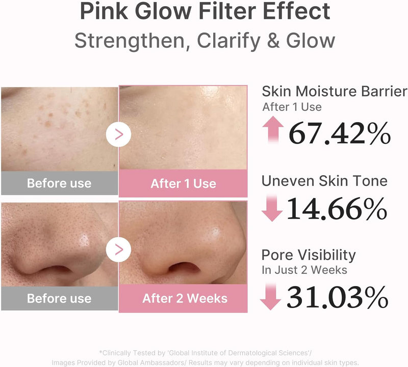 PDRN Pink Peptide Serum Sodium DNA 1%, Pink glow serum, Peptide, Niacinamide, Hydrating & Moisturizing & Plumping, Uneven Skin Tone, Korean Skincare 30ML (1.01 fl.oz., Salmon DNA PDRN)