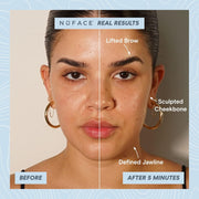 NuFACE TRINITY+ PRO Starter Kit - Lift, Contour & Tone your skin - Smart Advanced Facial Toning Device - Includes Silk Crème & Aqua Gel