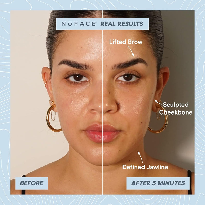 NuFACE TRINITY+ PRO Starter Kit - Lift, Contour & Tone your skin - Smart Advanced Facial Toning Device - Includes Silk Crème & Aqua Gel