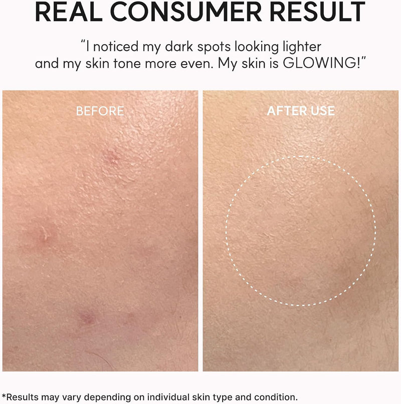 TXA Booster Shot Serum with 5% Tranexamic Acid & Peptides, Skin Tone Balancing & Hydration Support, Lightweight Daily Skincare, 30 mL / 1.01 fl. oz.