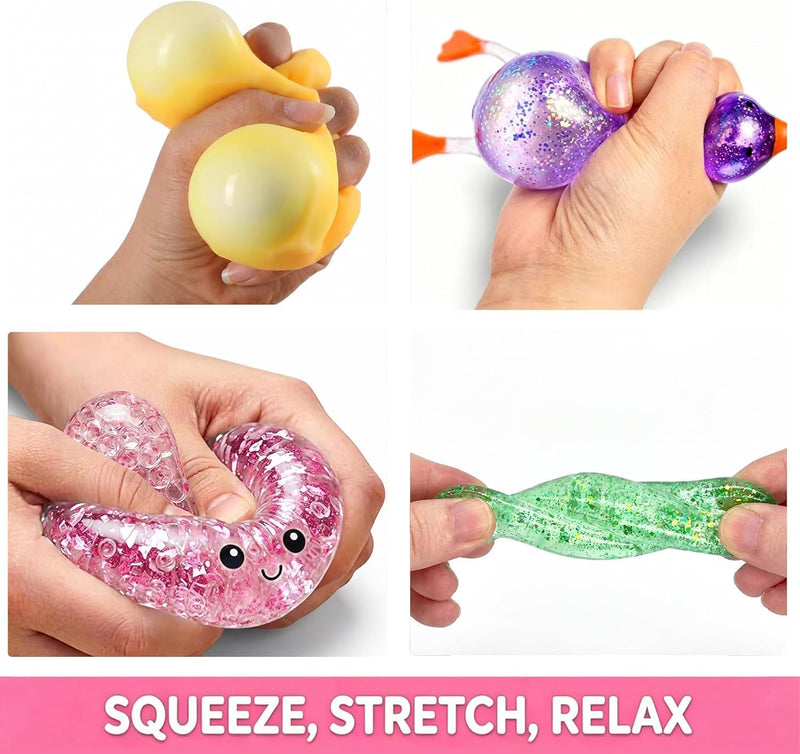 SLEEPHEAD Squishy bun Advent Calendar, 25 PCS bun Mystery Surprise Fidget Toys, Stress & Anxiety Relief Sensory Toys for Kids & Adults, Ideal Holiday & Birthday Gift