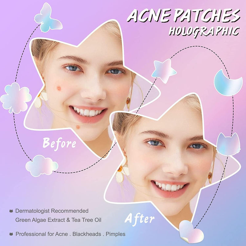 KANZA - 30 Pcs T-Zone Hydrocolloid Patches| Cleansing Blackhead Remover| Acne Patch Pimple Remover for Zit Breakouts |Nose and Forehead Patch |Painless,Safe |Removes Pimple,Acne Nose Gunk Pores