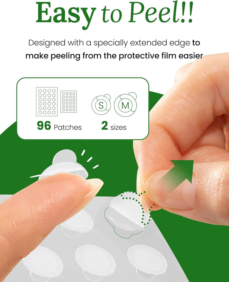 Troubless Invisible Pimple Patch Classic, 96 Patches (2 Sizes) – Ultra Thin Hydrocolloid Spot Treatment for Daytime Use, Easy Peel, Fast Healing, Absorbs Oil & Impurities, For Acne-Prone Skin