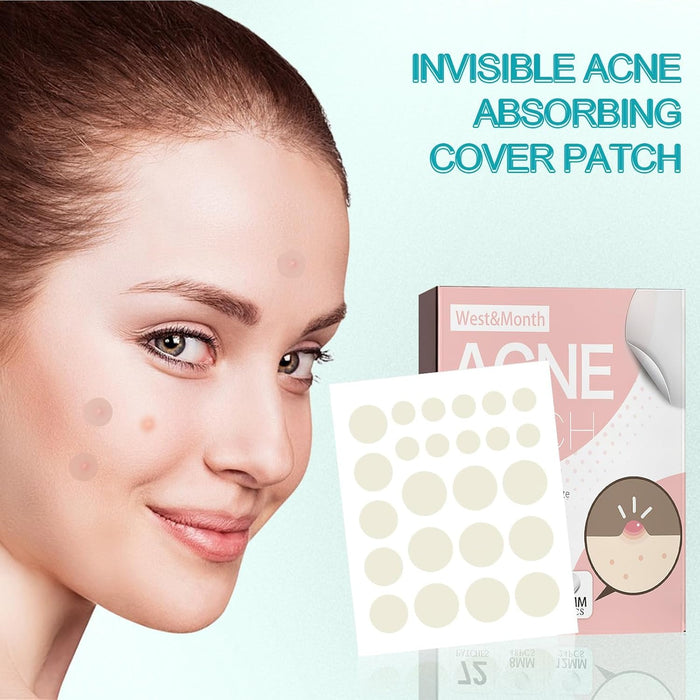 NALACAL Hydrocolloid Acne Healing Patches – 288 Waterproof Pimple Patches for Blemish Care, Anti-Acne Spot Treatment with Moisturizing Protection to Speed Up Skin Recovery and Promote Clear Skin