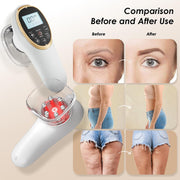 Angju 4-in-1 Body Sculpting Machine - Professional Cellulite Massage Tool with Lymphatic Drainage & Skin Tightening, Body Sculptor for Back, Abdomen, Waist, Arms, Legs and Buttocks