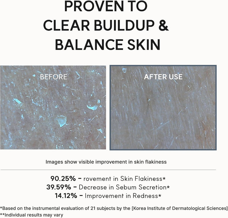 Eraser Serum Glycolic Acid Booster with AHA BHA, Exfoliating Face Serum for Acne-Prone Skin, Pore Care & Texture Refining, Lightweight Daily Skincare, 30 mL / 1.01 fl. oz.