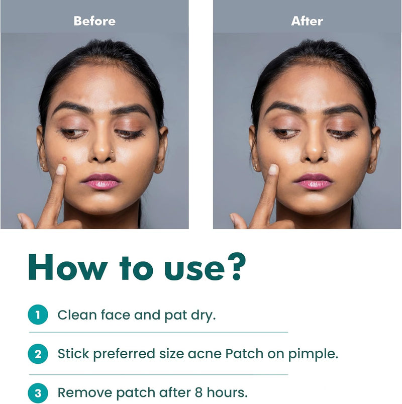 FemiSafe Acne Pimple Patch | 72 Invisible & Waterproof | Enriched with Salicylic Acid & Hydrocolloid | Spot Acne Patches for Unisex| Reduces pus overnight | Heal acne scars in 5-7 days |Sizes 8-12 mm