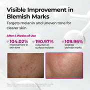 Cemenrete Picotonic Shot Calcium Ampoule for Even Skin Tone & Skin Clarity, 1.01 fl.oz.