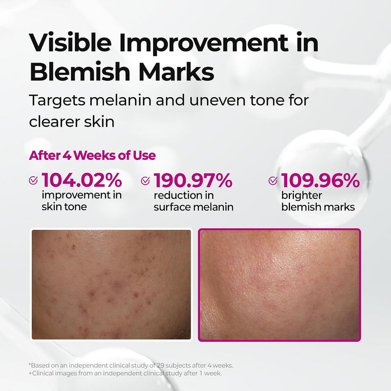 Cemenrete Picotonic Shot Calcium Ampoule for Even Skin Tone & Skin Clarity, 1.01 fl.oz.