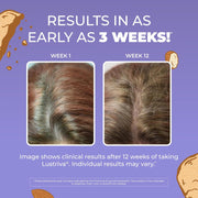 Women'S Hair Growth Max Liposomal With Lustriva Biotin 10000Mcg Pumpkin Seed Oil Thicker Care Wrinkles, Fine Lines, Skin Ages 18 15.22 Fl Oz