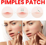 DWUENT Star & Heart Hydrocolloid Acne Patches 400pcs - Cute Colorful Pimple Dots with 2 Travel Boxes, Fashion Skincare for Blemish Care