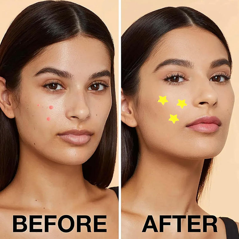 32Pcs Starface Patches,Cute Star Face Zit Covers Hydrocolloid Patch Pad Sticky Spot,Star Pimple Stickers Patches Hydrocolloid Pimple Patches for Teens Absorb Fluid and Reduce Redness for Face And Skin