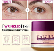 Calcium Dark Spot Eye Cream