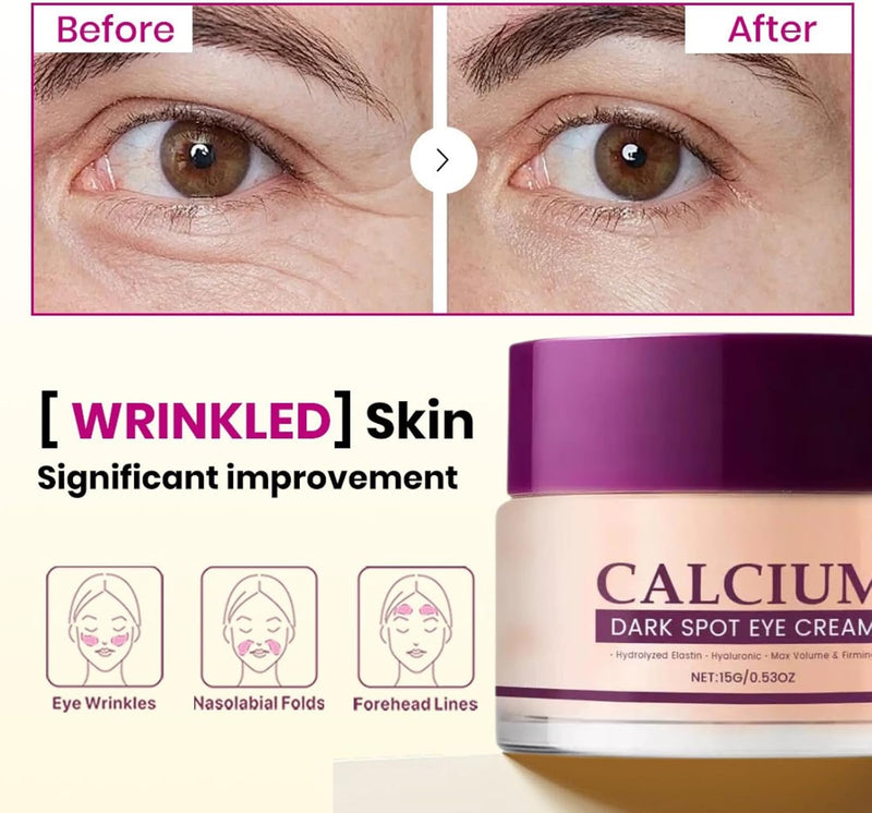 Calcium Dark Spot Eye Cream