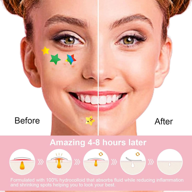 MAKINGTEC 96 Patches Cute Star Pimple Patches, Face Pimple Patches, Acne Healing Patches, Hydrocolloid Acne Patches for Face Blemish, Zit Acne Dot Acne Pimple Absorbing Cover Patch (Stars Shape)