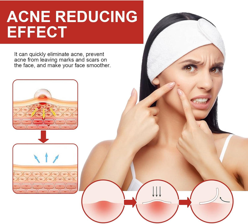 Pepisky 249 Pcs Pimple Patches for Face, Hydrocolloid Blemish Pimple Patches, Colorful star/heart/round shapes Acne Pimple Patch for Covering Zits and Blemishes
