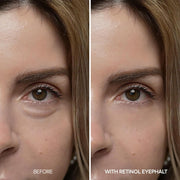 Dr.Melaxin Eyephalt Retinol Eyebag Cream 10ml