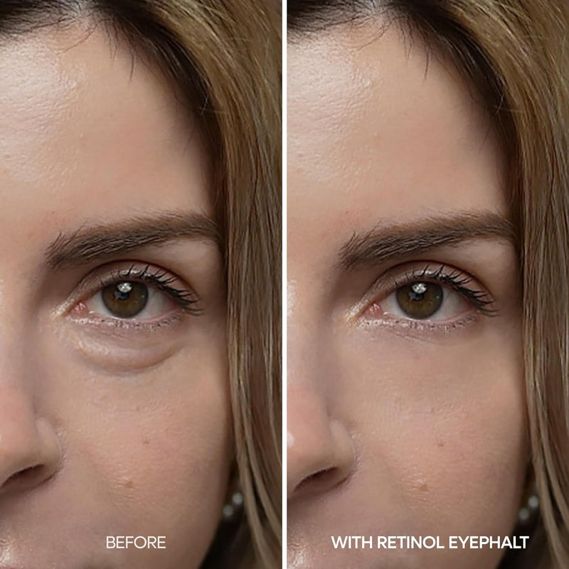 Dr.Melaxin Eyephalt Retinol Eyebag Cream 10ml