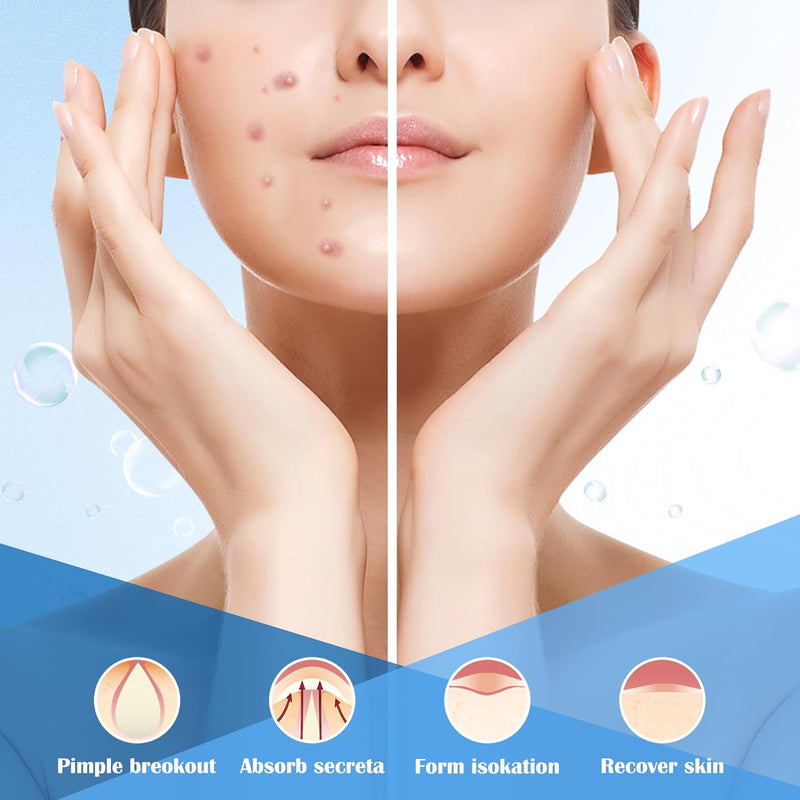 EKIND 180PCS Pimple Patches, Hydrocolloid Acne Patches for Face, Invisible Spot Cover for Blemishes & Breakouts, 2 Size Zit Patches