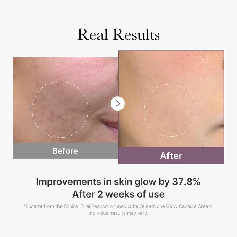 AGE-R Glutathione Glow Capsule Facial Cream - Instant Lifting Moisturizer - Collagen Peptide For Hydrating Glow - Improve Blemishes, Uneven Skin Tone - Korean Skin Care 1.69 fl.oz