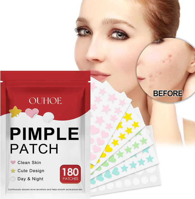 NALACAL Hydrocolloid Pimple Patches – Anti-Acne, Waterproof and Moisturizing Patches for Fast Healing and Blemish Protection
