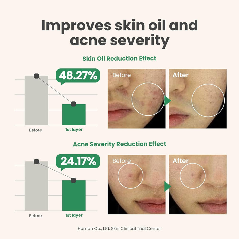 AXIS-Y Spot The Difference Blemish Spot Treatment 15ml - 4-Terpineol 2% Niacinamide AHA BHA Soothes Breakouts & Skin Barrier Repair - Vegan Korean Skin Care Face Serum - 0.50 fl. oz.