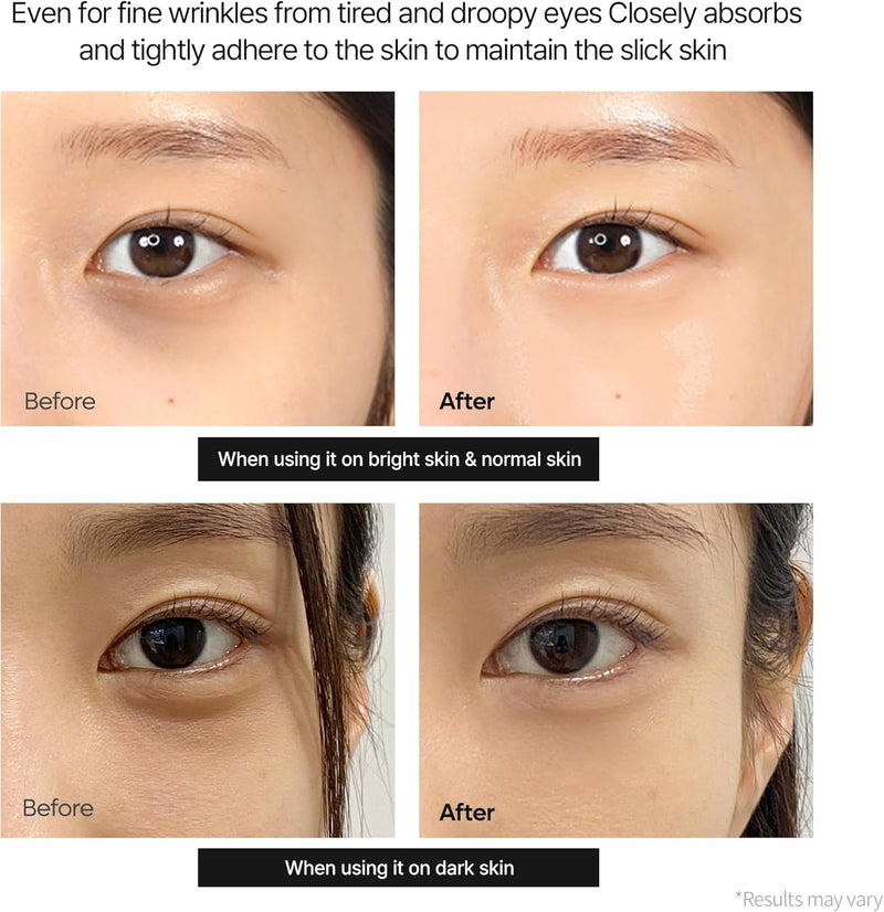 Dr.Melaxin Cemenrete Calcium Dark Spot Cover Eye Cream 15G