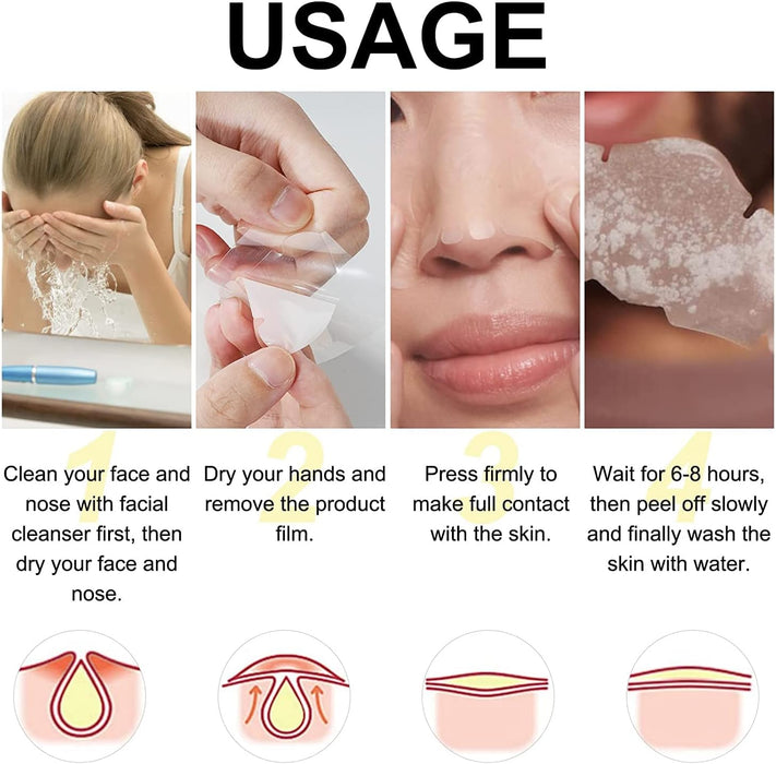 SYOSI Hydrocolloid Nose Patch, 1 Pack-12 Pcs, Blackhead Nasal Patch, Deep Cleansing Pore Strips, Remove Blackheads and Unclog Pores, Clean Oily Skin