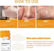 Arabest Nose Strips, 10 Count Nose Patch, Hydrocolloid Patches Nose with Instant Blackhead Removal and Pore Unclogging, Blackhead Patches Nose for Pimples, Zits and Oil
