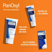 10% Benzoyl peroxide Acne Foaming Wash, Oil Control Moisturizer & Patches Bundle