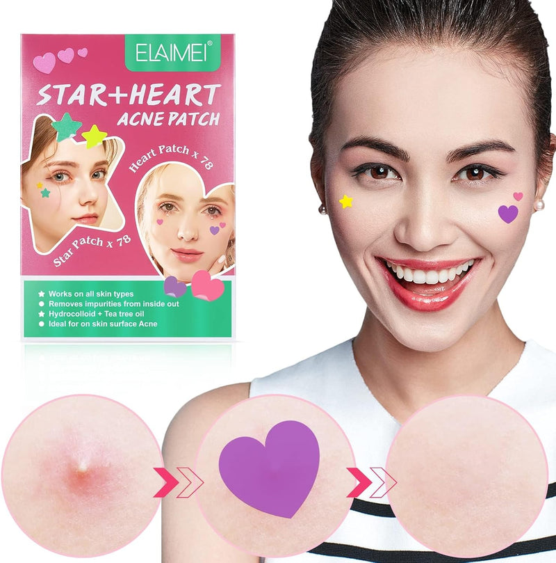 Pimple Patch, Patches Acne Patch, Salicylic Acid Hydrocolloid Spots Plasters, Microneedle Spot Skincare Patches, Mighty Smallpox Treatment Stickers, Zit Remover, Teen 156Pcs (Pink, Green)(Star, Heart)
