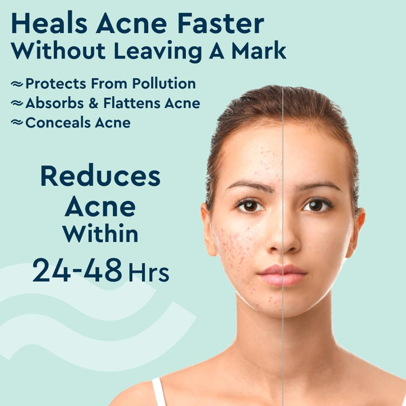 GUBB Acne Pimple Patches - Invisible Facial Stickers cover with 100% Hydrocolloid, Pimple Patches for Face, Acne Patches for Face (36 Pieces)
