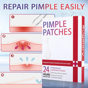Sugelary 252 Pcs Pimple Spot Patches, Day and Night Use 2 In 1 Natural Invisible Hydrocolloid Spot Mighty Patches Dots for Spot Absorbing Patches for Face