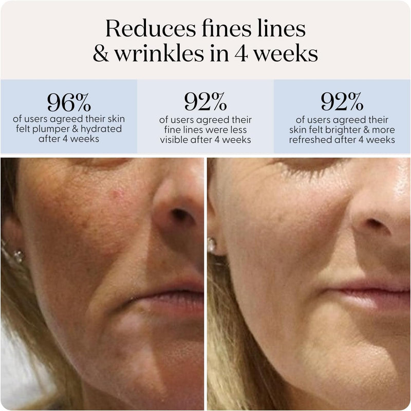 SmoothSkin Red Light Therapy for Face, Hydrate & Glow Kit, LED & Infrared Mask, Beauty Device for Youthful, Glowing Skin & Reduced Wrinkles
