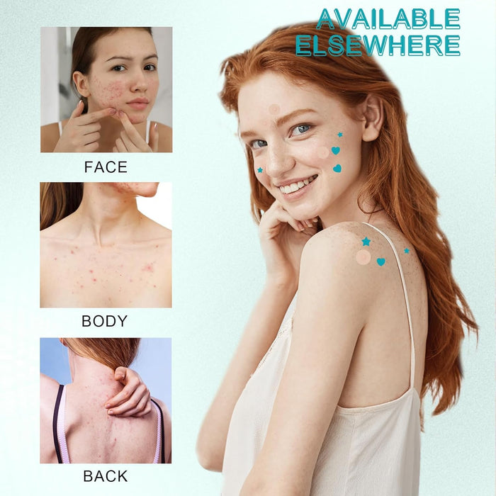 NALACAL Hydrocolloid Acne Healing Patches – 288 Waterproof Pimple Patches for Blemish Care, Anti-Acne Spot Treatment with Moisturizing Protection to Speed Up Skin Recovery and Promote Clear Skin