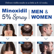 Minoxidil 5% for Men (120 ML), Advanced Minoxidil Spray with Provitamin B5 and Castor Seed Extract, Hair Loss Serum for Hair Growth and Beard Restoration - Minoxidil