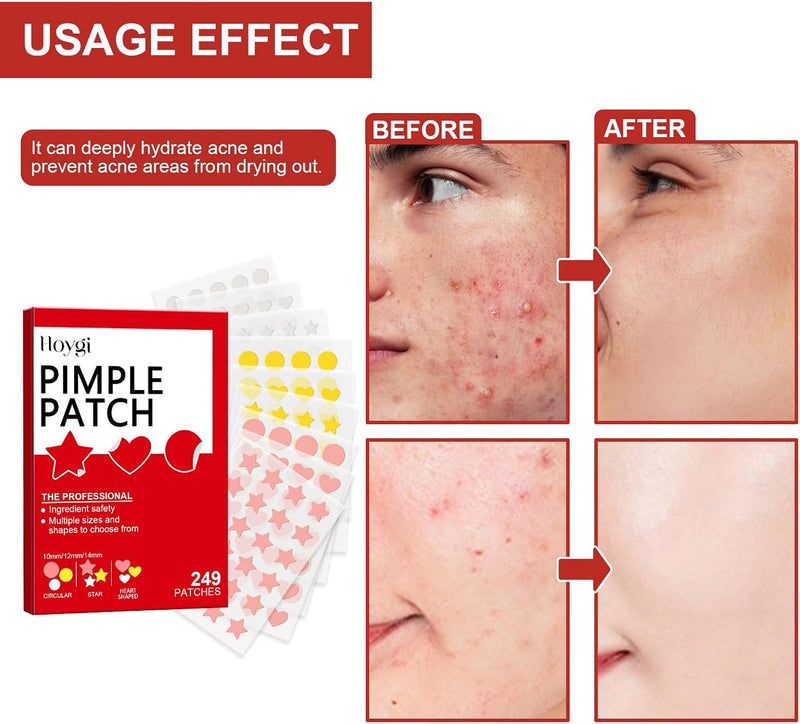 Pepisky 249 Pcs Pimple Patches for Face, Hydrocolloid Blemish Pimple Patches, Colorful star/heart/round shapes Acne Pimple Patch for Covering Zits and Blemishes