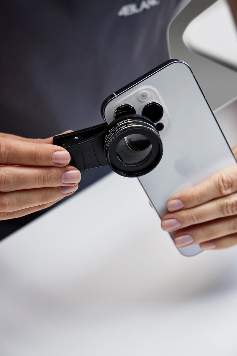 4BLANC External Macro Lens Kit with Mount for Any Smartphone