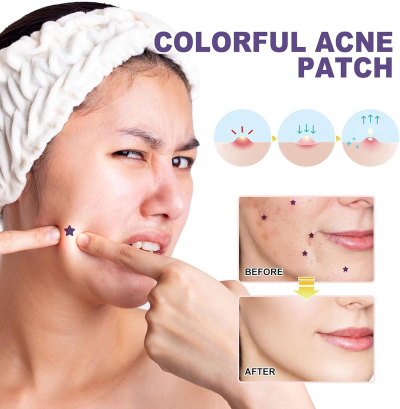 Azonee Pimple Patches for Face, Hydrocolloid Acne Patches Cute Star Zit Covers Spot Cover Stickers 180 Pcs with Tea Tree Salicylic Acid Natural Green Algae Extract Blemish Spot Stickers, 5 Styles