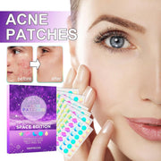 Azonee Pimple Patches for Face, Hydrocolloid Acne Patches Cute Star Zit Covers Spot Cover Stickers 180 Pcs with Tea Tree Salicylic Acid Natural Green Algae Extract Blemish Spot Stickers, 5 Styles